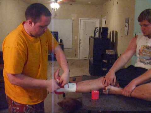 How To Tape An Ankle Knes 205.wmv