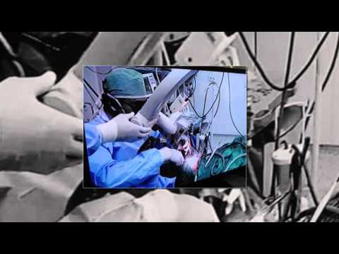 ورشة عمل وحدة علاج امراض النوم بين اطباء جامعة المنصورة واطباء الهند