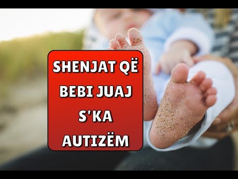 Shenjat që bebi juaj s’ka autizëm