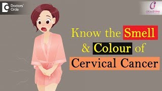 Smell and Colour of Cervical Cancer | Check for these Important Signs !!! - Dr. Sapna Lulla