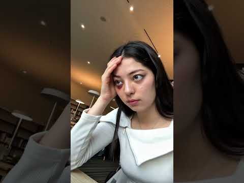 Is my nose broken?😭