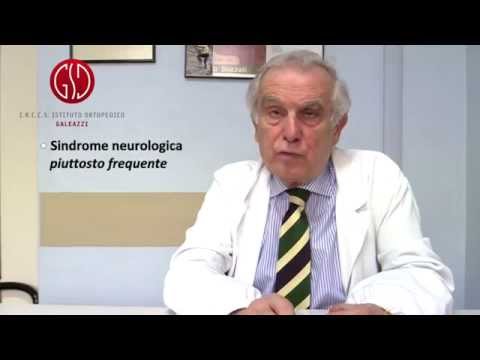 La risposta dell'Esperto – Malattie extrapiramidali: malattia di Parkinson