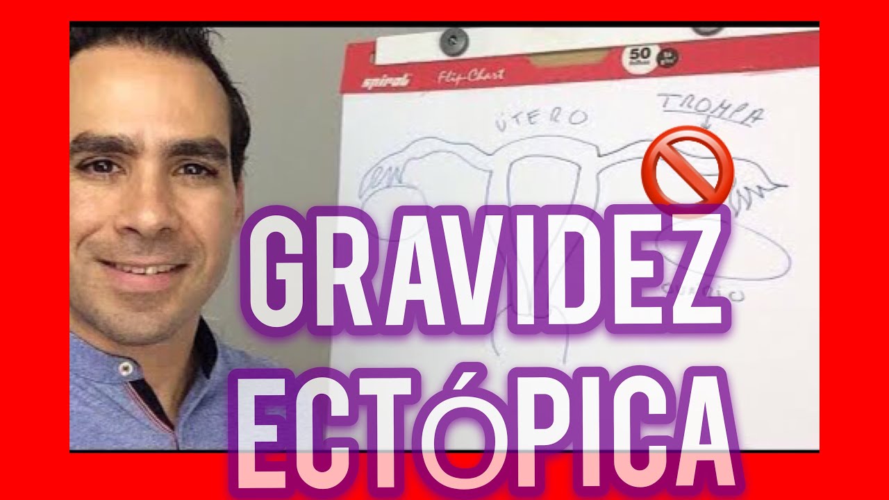 🔴Gestação ECTÓPICA! Por qué acontece e o Qué podemos fazer?- Bate-papo da FERTILIDADE!