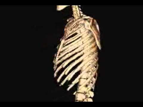 Skeleton from Helical CT Scan