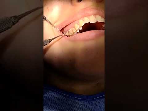 Smile center  - Tratamiento dental para el sangrado de las encías en Barranquilla