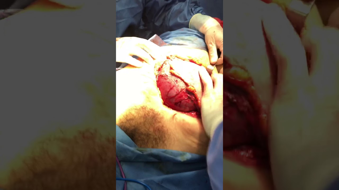 Brian Axel Rojas Bahena-6