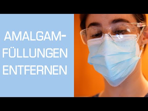 AMALGAMFÜLLUNGEN ENTFERNEN || KARIES BEHANDELN