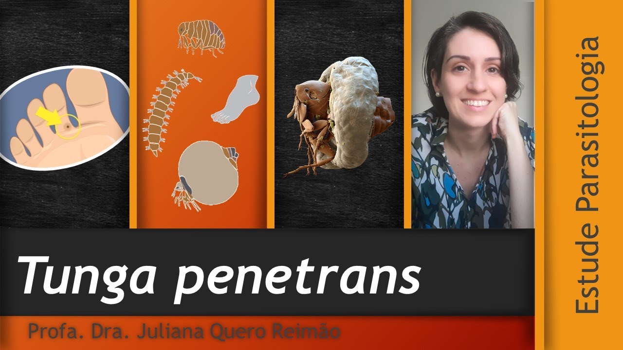 Aula sobre Tungíase (Bicho de pé), causada pela pulga Tunga penetrans