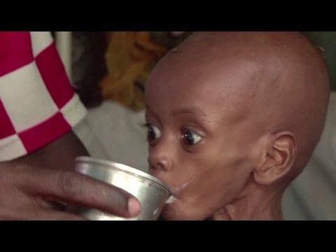 Somalia padece grave hambruna