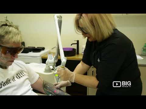 City Tattoo Removal in Brisbane offering the best Laser Tattoo Removal