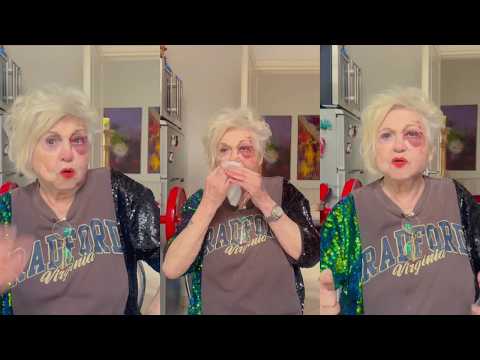 Wanna Marchi piena di ematomi presenta il suo libro di cucina e parla di ricette deliziose