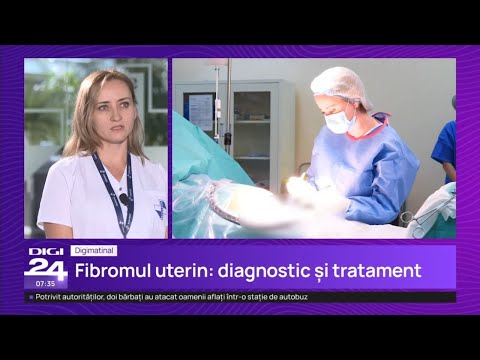 Fibromul uterin – Dr. Ingrid Gheorghe | Spitalul Clinic SANADOR