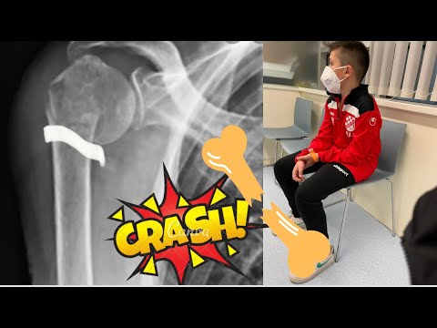 Gegen SV Wienerberg mit gebrochener Arm