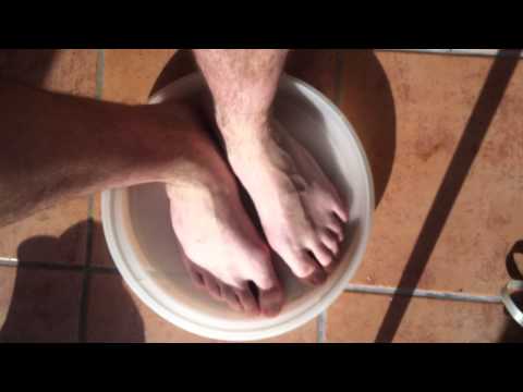 comment soulager oedeme cheville