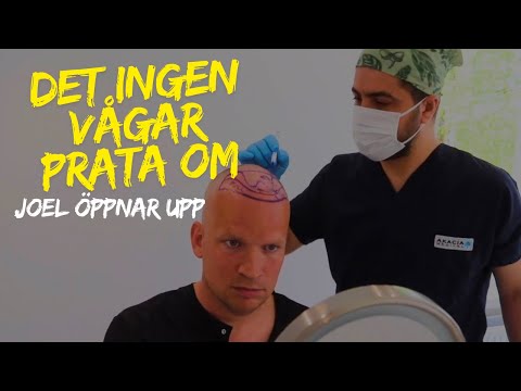 Bir Amerikalı saç ekimi için İsveç'e gidiyor