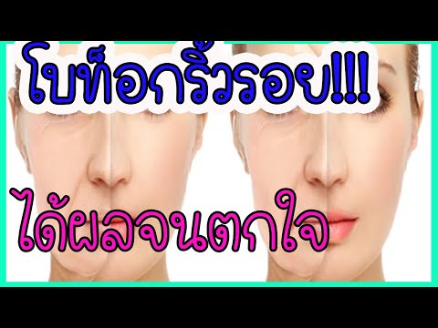 โบท็อก ลดริ้วรอย