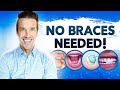 Straight Teeth Without Braces!? | Dr. Nate