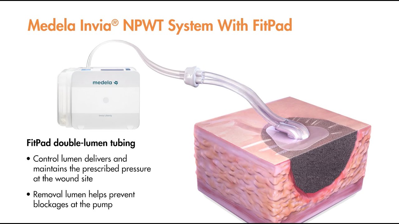 negative pressure wound therapy vac