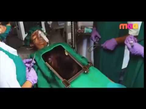 Funny Telugu - Heart Transplant