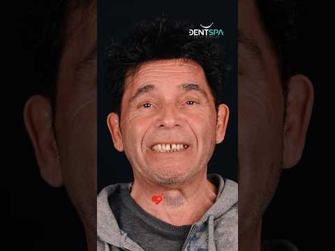 Refresh Your Appearance with a Complete Smile Makeover Procedure in Istanbul, Turkey