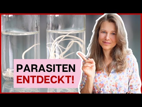 Parasites excreted alive! Shocking experience & how I got rid of them