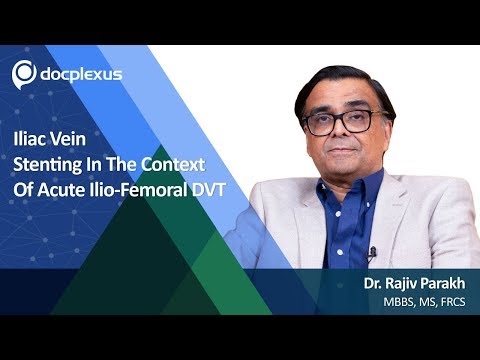 Iliac Vein Stenting In The Context Of Acute Ilio-femoral DVT
