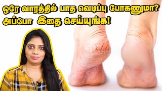Home remedy for silky smooth feet | Crack Heel Treatment