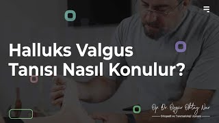 Halluks Valgus Tanısı Nasıl Konur? - Ortopedi ve Travmatoloji Uzmanı O