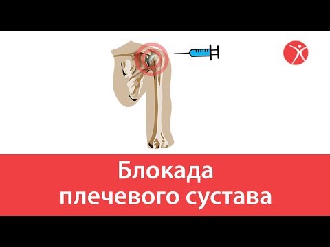 Индометацин при болях в пояснице Йод при заболеваниях суставов