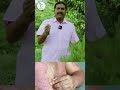 எப்படிபட்ட தோல் நோயும் சரியாகும் ரகச