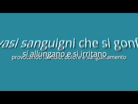 Sostituzione dellarticolazione sulle dita Ricetta funghi velenosi per le articolazioni