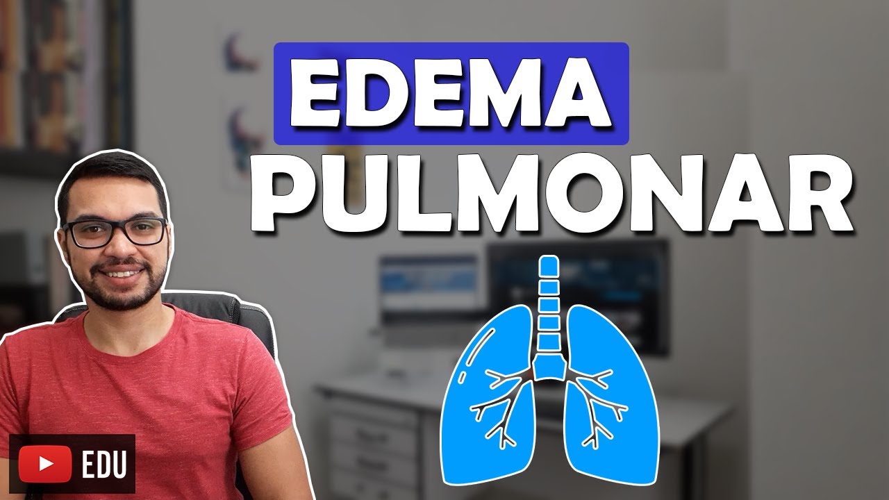 EDEMA CARDIOGÊNICO X NÃO CARDIOGÊNICO [Respiratório 11]