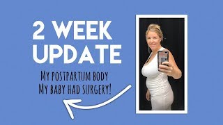 2 week update: my baby had surgery + my postpartum body