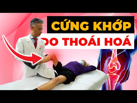 Tại Sao Khớp Gối Của Bạn Cứng Như Gỗ? Nguyên Nhân Thật Sự Là