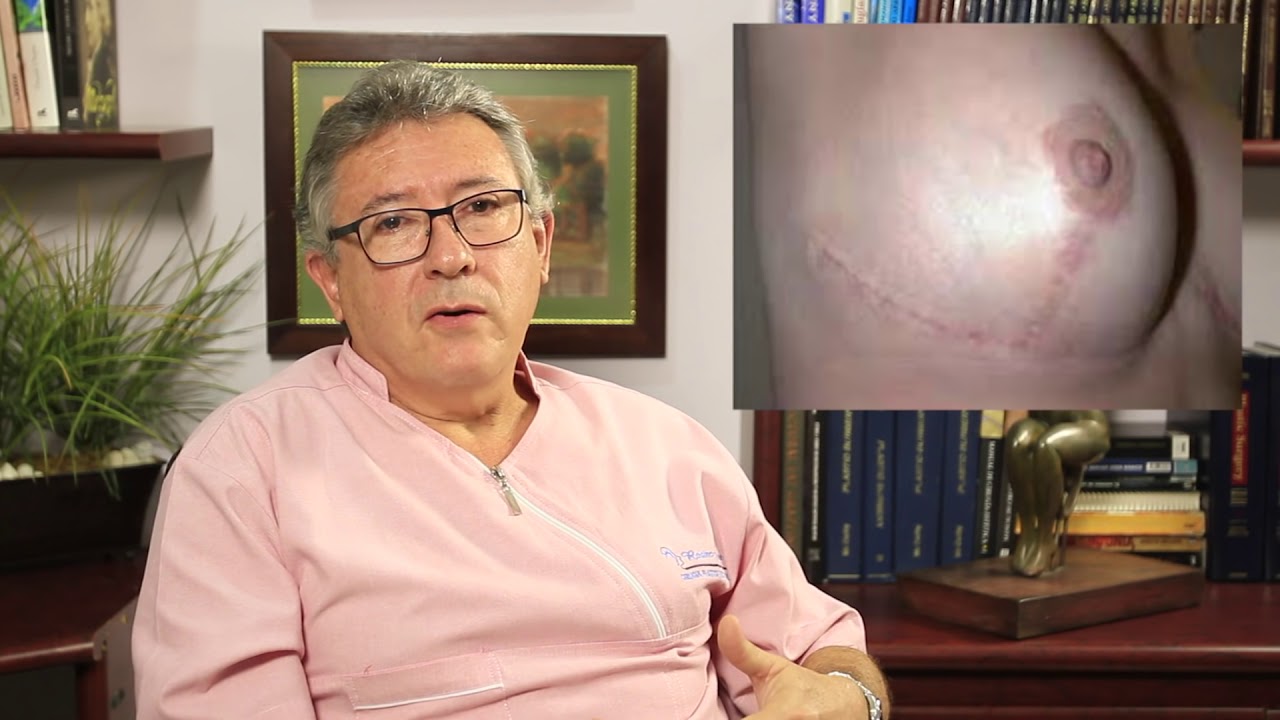 Watch Cap. 10 Mamoplastia de Reducción Now Cap. 10 Mamoplastia de Reducción