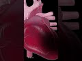 Heart Attack Explained Animation