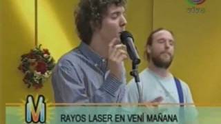 Rayos Laser - Mintiendome