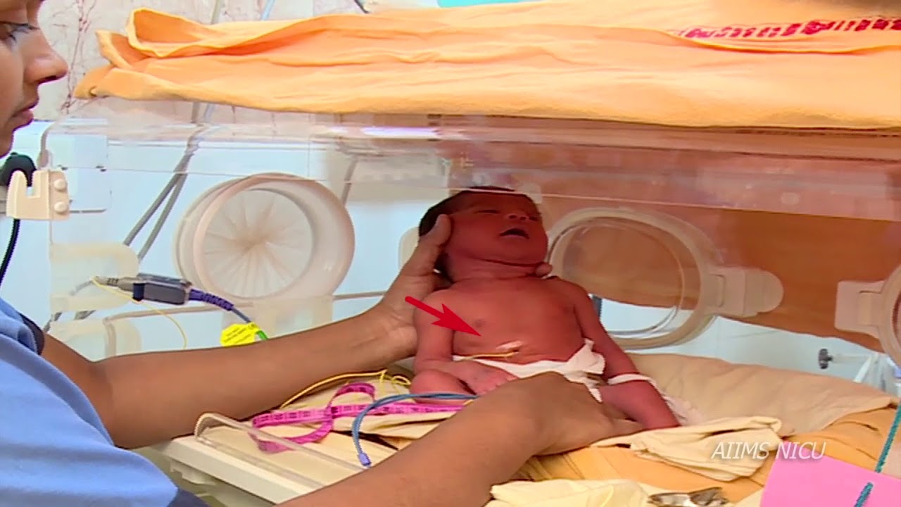 How to use an Incubator?