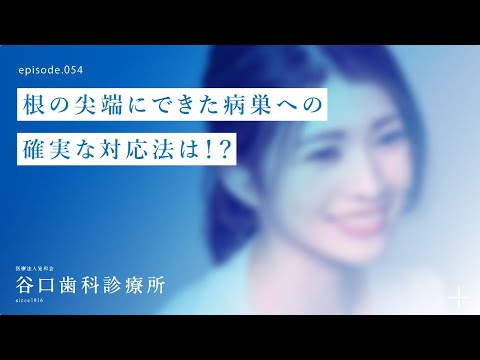 第54話 根の尖端にできた病巣への確実な対応法は⁉️-札幌駅前-赤れんがテラス-谷口歯科診療所