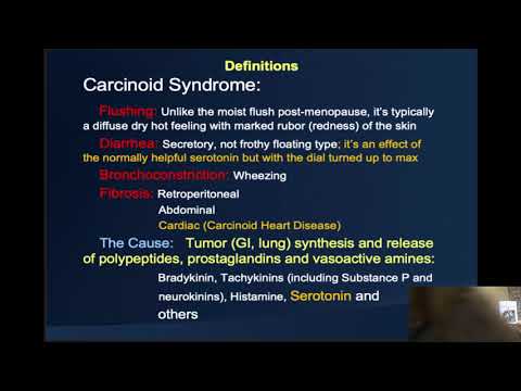 07 Zacks Carcinoid Heart Disease VA 2019