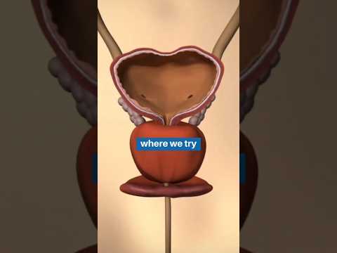 Uro Dynamic Study |Dr Aditya Urologist