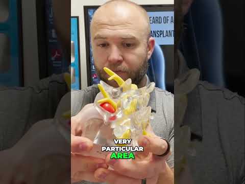 Correcting Cervical Herniated Discs | Chiropractor for Neck Pain in Lincoln, NE