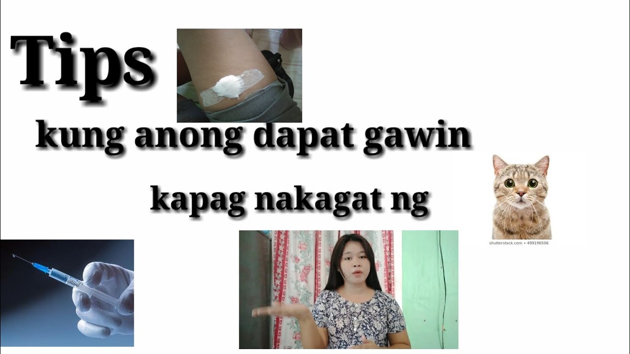 Putar video Tips kung anong dapat gawin kapag nakagat ng Pusa ( Animals bite tips to do) sekarang Tips kung anong dapat gawin kapag nakagat ng Pusa ( Animals bite tips to do)