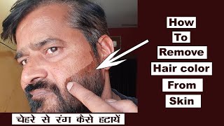 👩‍🦱💇‍♀️💦 How to Remove Hair Color/Dye from Skin | चेहरे पर लगे हेयरडाय के निशान कैसे साफ करें 💄🚿