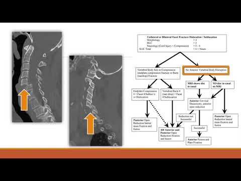 Indications: Subaxial Cervical Trauma:  Luis Daniel Diaz-Aguilar, MD
