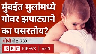 Mumbai Measles Epidemic: गोवर म्हणजे काय? मुंबईत गोवरचे रुग्ण का वाढत आहेत? सोपी गोष्ट 730