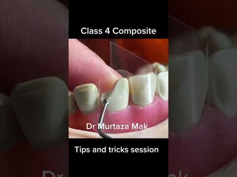 Class 4 Composite tips and tricks session