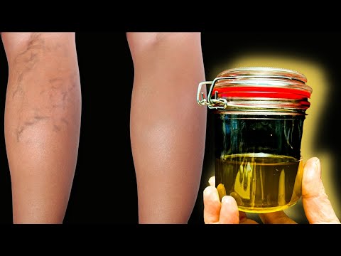 In just 3 days! Say goodbye to joint pain, arthritis, rheumatism. Grandma's recipes