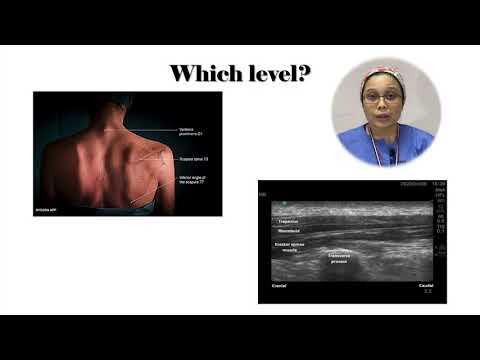 The Erector Spinae Plane Block - The Future of RA in ED