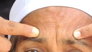 HOW TO GET RID OF DEEP FOREHEAD WRINKLES NATURALLY | HOME REMEDIES FOR WRINKLES ON FOREHEAD